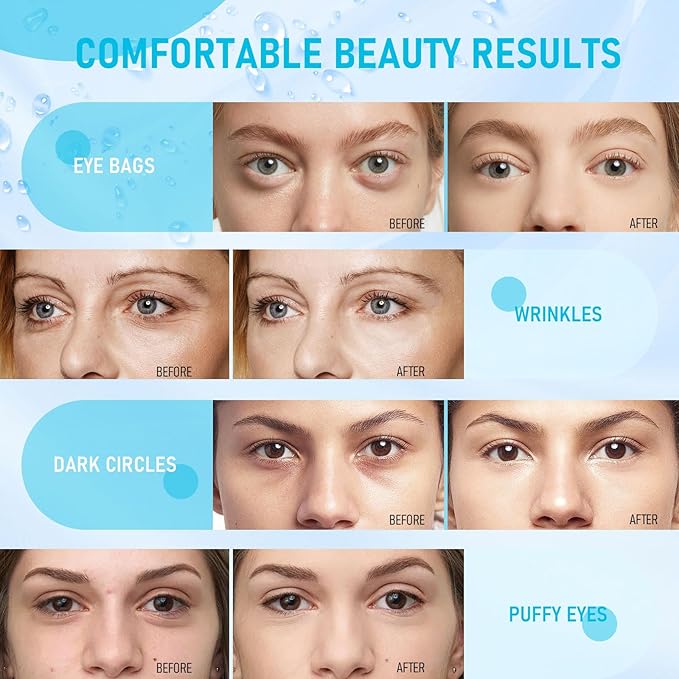 LAVONE Under Eye Patches-30 Pairs Hydrating & Anti-aging Eye Mask Skin Care for Dark Circles and Puffiness,Reduce Wrinkles,Eye Bags and Fine Lines,Eye Masks for Women and Man,with Hair Clips