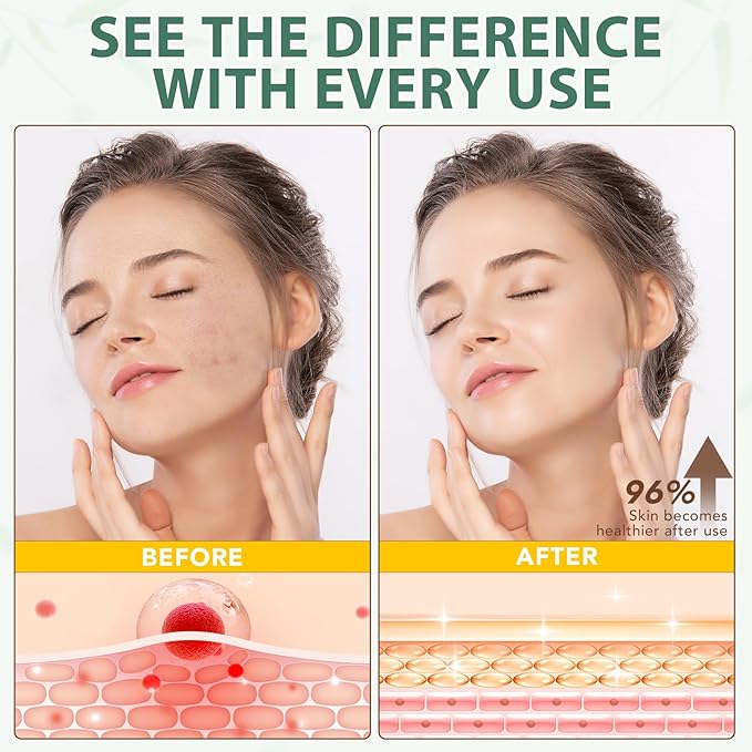 Beef Tallow for Skin, Tallow and Honey Balm, Organic Grass Fed Whipped Beef Tallow with Honey Beeswax, Deeply Moisturizes Face & Body, Repair Skin, 4.2 Oz