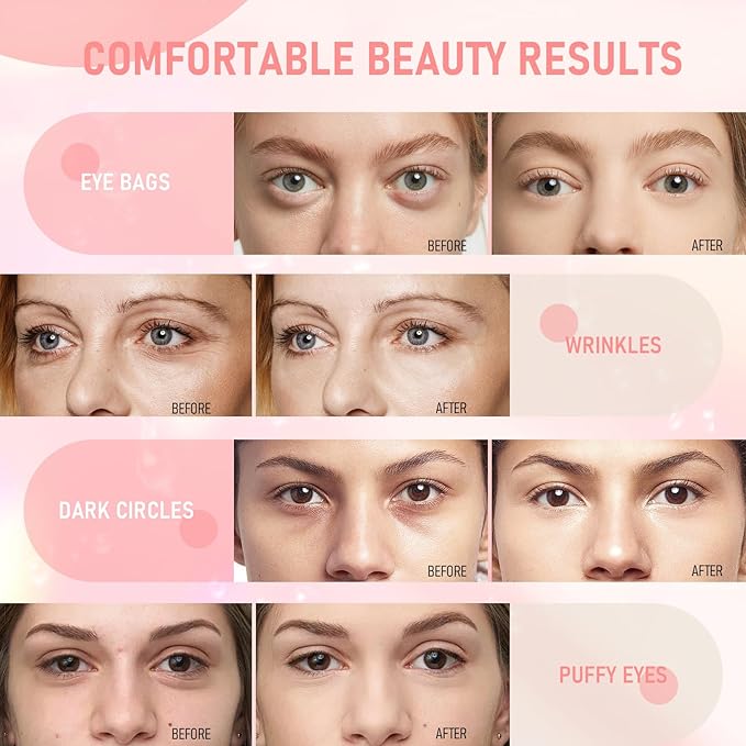 Eye Mask - 30 Pairs Rose Under Eye Patches Skin Care Products,Eye Masks Skincare for Dark Circles and Puffiness, Reduce Wrinkles, Eye Bags and Fine Lines, for Women and Man