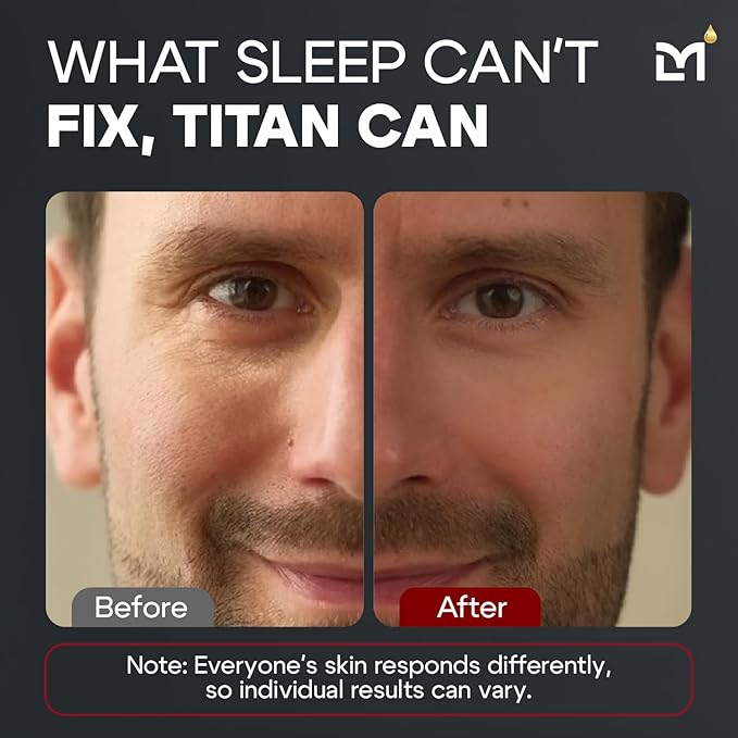 Titan Peptide Cooling Eye Gel – Mens Eye Cream – Anti-Aging Bags & Dark Circle – Eye Bags Treatment for Men – High Potency – Puffy Eyes Treatment for Men – Peptides, HA, DMAE, MSM – Unscented