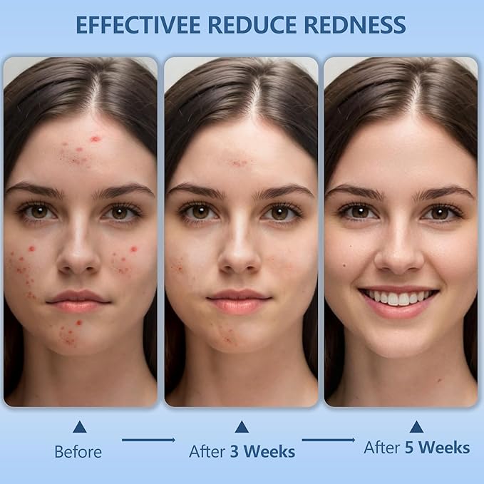 Disposable Face Towels, 12"×12" Extra Large Face Towelettes, Ultra Soft Facial Towels for Sensitive Skin, Makeup Remover Dry Wipes, 55 Count (1 Pack)