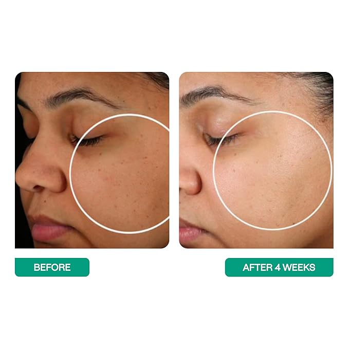 BeautyStat Cosmetics Women's Universal Pro-Bio Moisture Boost Cream, 1.7 Ounce