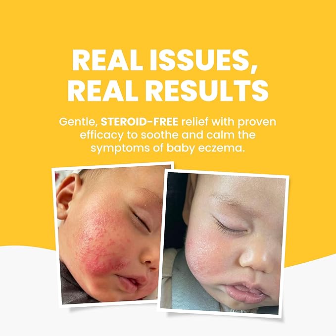 Grahams Natural Baby Eczema Cream Moisturizer for Newborn-12 Years | Rash, Redness, Dry Skin & Itch Relief | Colloidal Oatmeal & Shea Butter | Steroid-Free, Fragrance-Free for Sensitive Skin (75g)