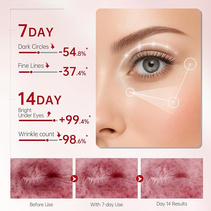 Peunitory Eye Balm Stick,Under Eye Cream Anti-Wrinkle Firming Treatment | Dark Circle Brightener | Hydrating (0.32oz)