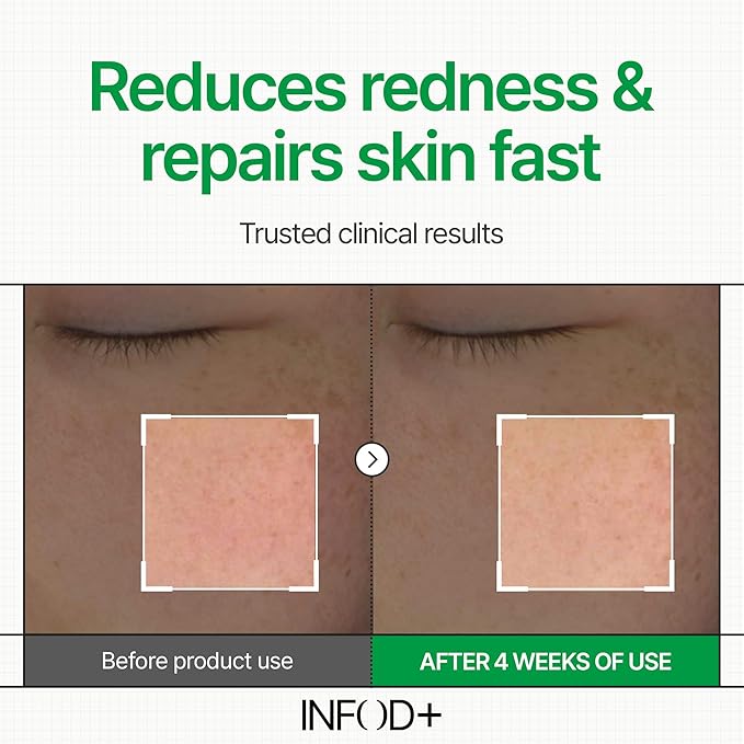 INFODPLUS Repair Cream 50ml – Exosome & Ceramide Complex | Barrier Repair, Hydrating, Anti-Aging Face Moisturizer for Sensitive Skin