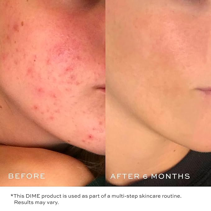 DIME Beauty Gentle Jelly Cleanser, Hydrating Facial Cleanser and Makeup Remover with Vitamin E, Face Wash for Sensitive Skin, 4 oz (120 ml)