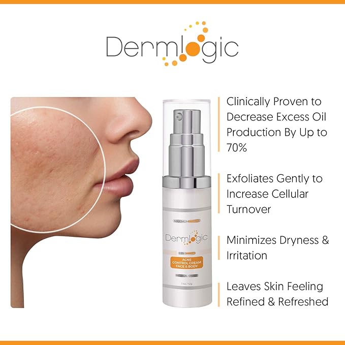 Acne Face & Body Cream- Maximum Strength Treatment for Cystic, Blackhead & Whitehead Pimples. Prevents Future Breakouts.