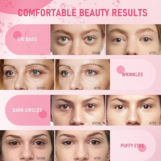 Eye Mask - 15 Pairs Rose Under Eye Patches Skin Care Products - Eye Masks Skincare for Dark Circles and Puffiness, Reduce Wrinkles, Eye Bags and Fine Lines, for Women and Man, with Hair Clips