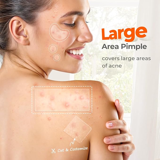 TKTK Large Pimple Patches for Face, 68 x 27 mm XL Hydrocolloid Bandages, Big Acne Patches for Body, Forehead, Chin, Nose, Chest and Back Blemish Zit Breakouts (Strip, Contoured, Dot 5 Sizes 136 Count)