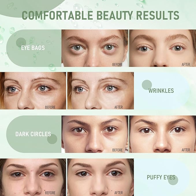 Eye Mask - 30 Pairs Green Tea Eye Patches Skin Care Products for Dark Circles and Puffiness, Reduce Wrinkles and Fine Lines, Eye Patches for Women and Man,with Hair Clips