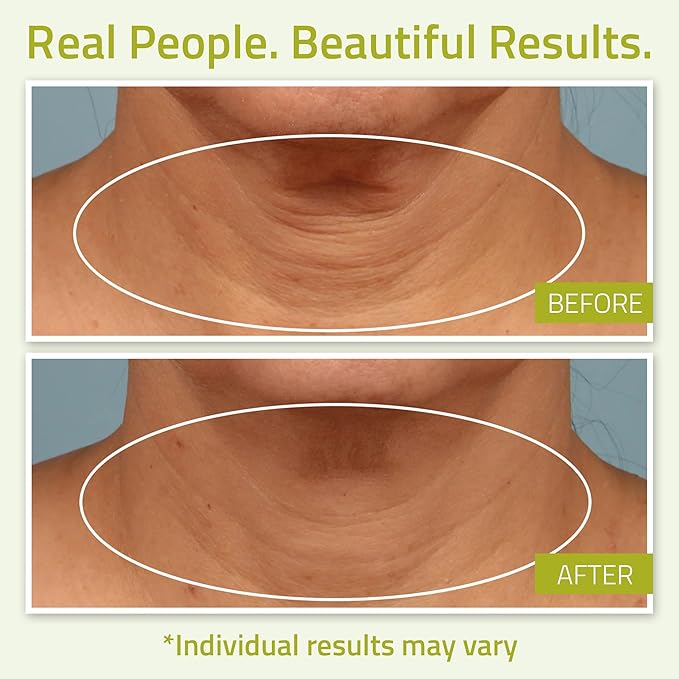 YEOUTH Neck Cream with Vitamin C, Neck Firming Cream for Women and Men, Firming Moisturizer Targets Double Chin, Décolletage, and Chest 2oz