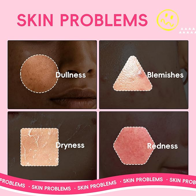 Niacinamide Serum for Face, Skin Care with Watermelon Extract & Hyaluronic Acid, Vitamin C, Hydrating, Glow, Anti-Aging, for Uneven Skin Tone, for Teens Girls Women Gifts, 1 Fl. Oz