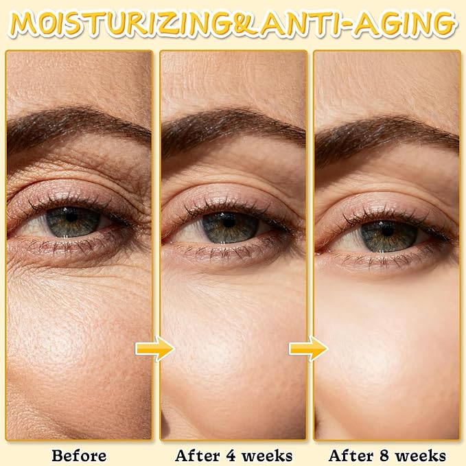 Beef Tallow for Skin, Tallow and Honey Balm for Face, Skin Care Cream Body Butter, Natural Formula, Nourish and Soothe Dry Skin, 120g/4.2oz