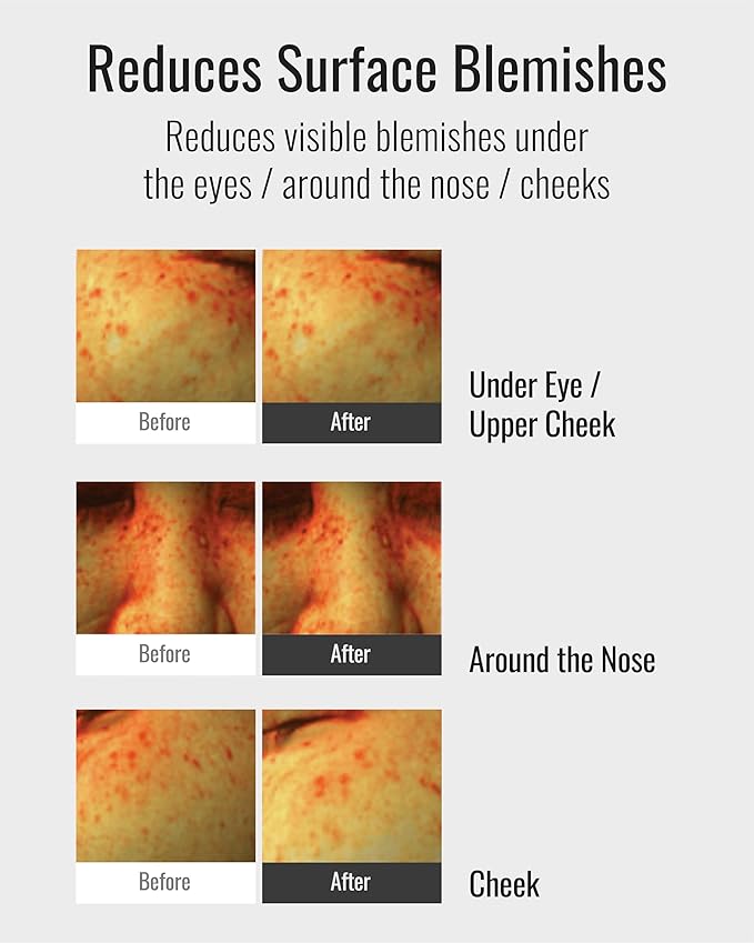 ISA KNOX Age Focus Mela Care Cream Set (3.7fl oz) - Dark Spot Moisturizer by LG Beauty. Niacinamide, Collagen, Vitamin B12, Vitamin C Derivatives.