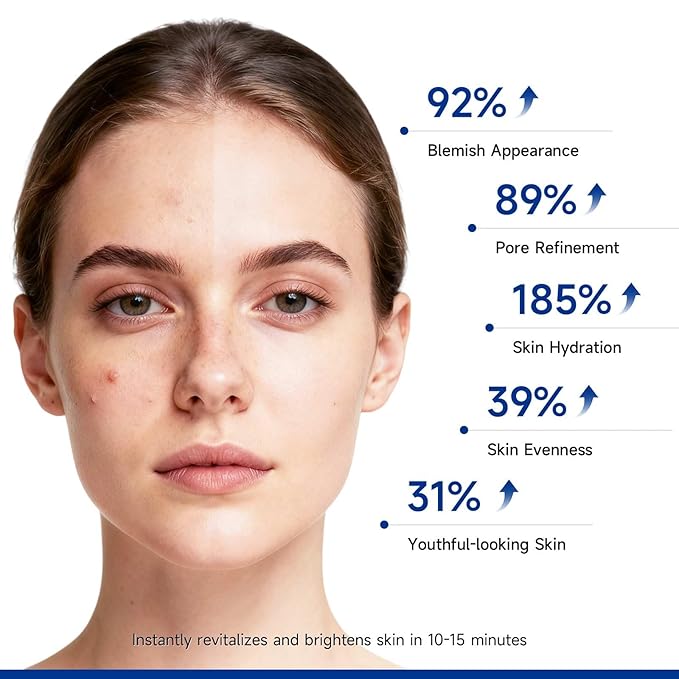 Dr.Vincent Brightened Clay Mask for Face, Deep Cleansing Kaolin Clay Masks for Blackheads and Pores, Soothing Mud Mask with Niacinamide for Dark Spots, Dull Skin, All Skin Types（5.3 oz）