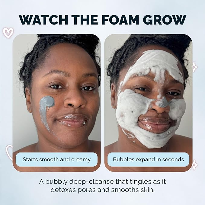 Elizabeth Mott Carbonated Bubble Detox Clay Mask – Korean Skincare for Deep Pore Cleansing, Acne, Blackheads & Oil Control – Charcoal Face Mask for Breakouts & Smooth Skin – Cruelty-Free, 3.53 oz