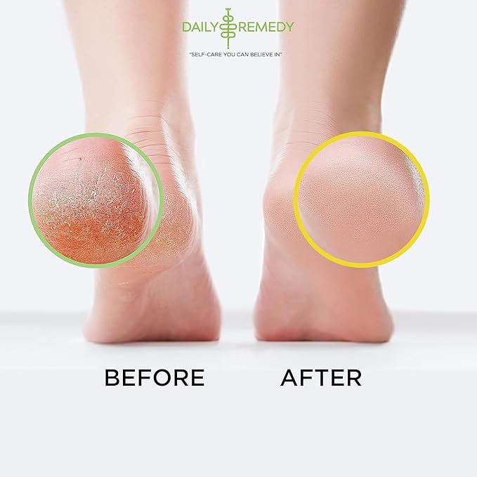 DAILY REMEDY 4-Pack Foot Soak Set - 2 Extra Strength Tea Tree Oil & 2 Citrus Detox - Made In USA - Soothes Tired Feet, Athletes Foot, Stubborn Foot Odor, Softens Calluses & Refreshes & Detoxifies