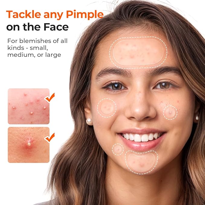 TKTK 443 Count Pimple Patches for Face, Hydrocolloid Acne Patch Bulk, Acne Stickers for Covering Cheeks, Forehead, Chin Blemishes Zit Breakouts for All Skin Types (Dots, Strip, Contoured 5 Sizes)