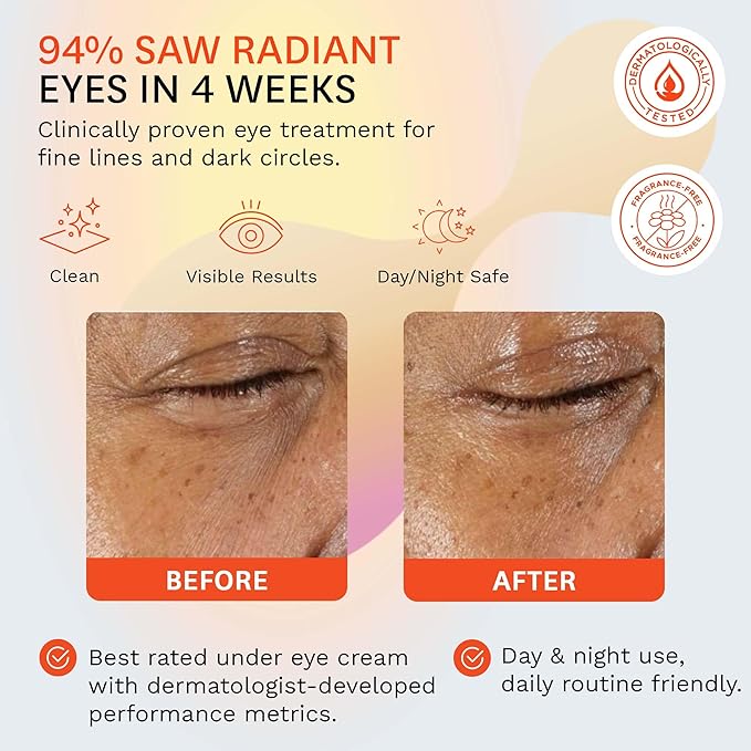 Fig.1 Vitamin C Eye Cream for Dark Circles, Puffiness & Wrinkles | Under Eye Cream for Women & Men | Glowing Eye Treatment | Refillable Anti Aging Moisturizer for Fine Lines