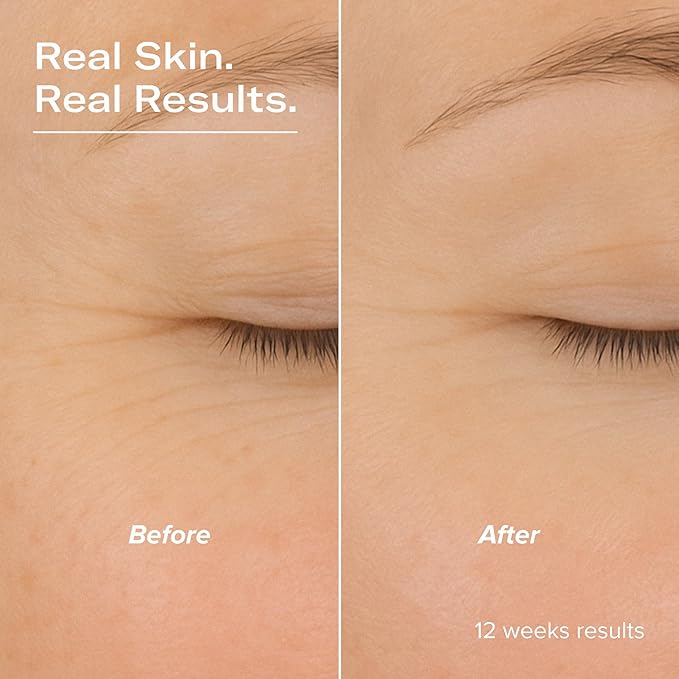 SMOOTH Retinol and Peptide Serum with Encapsulated Retinol, Bakuchiol, Matrixyl 3000, Melatonin, Vitamin E, Anti-Aging, Targets Fine Lines, Uneven Texture, Dullness, 1 fl oz