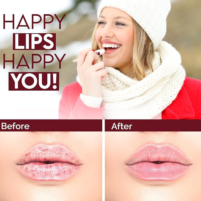 Natural Solution Lip Balm, Formulated with Cherry & Organic Shea Butter, Moisturizing Lip Care Multipack, Hydrating Moisturizer for Dry Lips, Organic Chapstick- 3 Count,6 Pieces