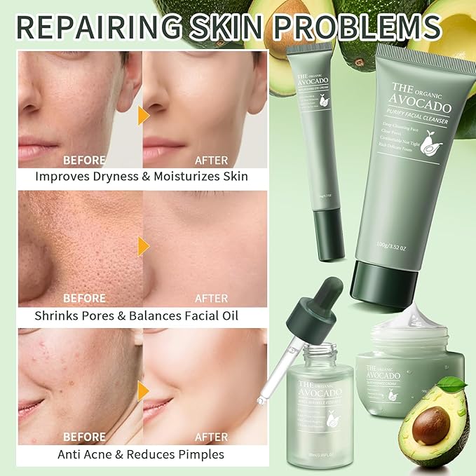 Avocado Skin Care Set, 9-In-1 Travel Skincare Kits for Hydrating & Soothing Skin, Daily Care Routine Kit with Avocado, Anti Aging Facial Kit for Women, Reduces Acne, Fine Lines & Wrinkles.