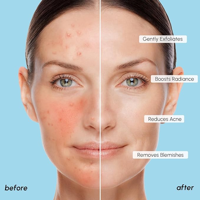 MAREE Glycolic Acid Polishes 2 PACK - Toner Polishes for Face Cleansing - Tea Tree Oil, Salicylic Acid & Vitamins E, B3, B5 - Facial Peel & Radiance Deep Cleaning Effect