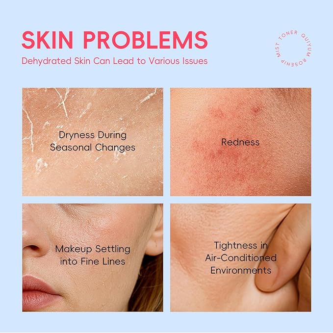 Skin Care Set, Rosehip Vitamin E Skincare Kits 5PCS- Beauty Skin Care for Women, Facial Skin Care Routine Set Kit, Restore Skin Elasticity, Refine Skin Texture, Even Skin Tone, for All Skin Types