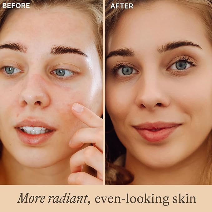 Vitamin C Face Serum - USA Made with Natural & Organic Ingredients, Skin Brightening Vitamin C Serum for Face for Women, Discoloration Correcting & Anti Aging Facial Formula with Antioxidants