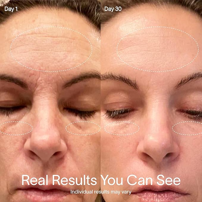 Solawave 4-in-1 Red Light Therapy Wand for Face & Neck | Beauty Device with Galvanic Current, Massager & Warmth | Anti-Aging, Wrinkle Reduction, Skin Tightening, Depuffing & Rejuvenation (Matte Black)