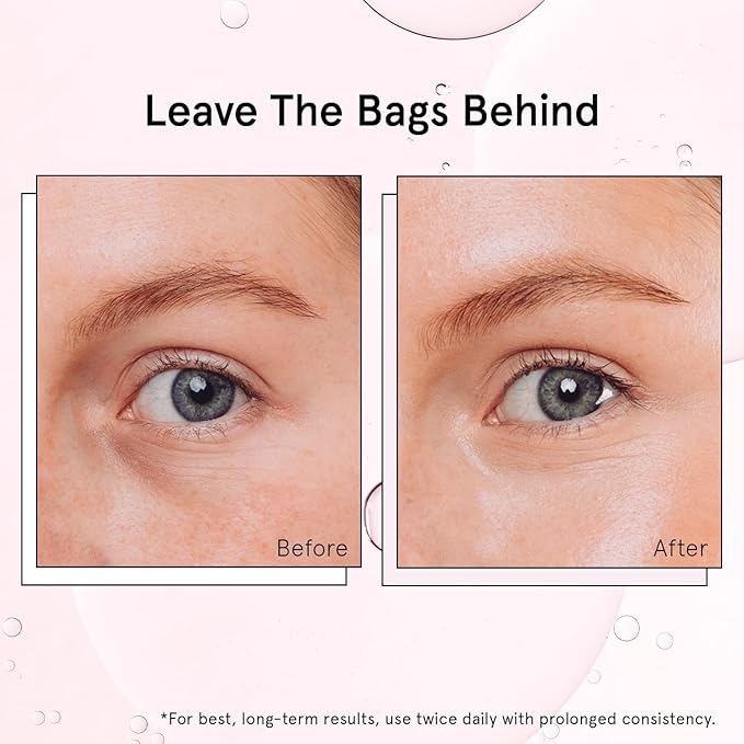 grace & stella Under Eye Brightener Roller - Airplane Travel Essentials - Travel Size Toiletries - Retinol & Caffeine Eye Serum for Puffiness, Dark Circles, Wrinkles - Vegan Skincare (15ml / 0.51floz)