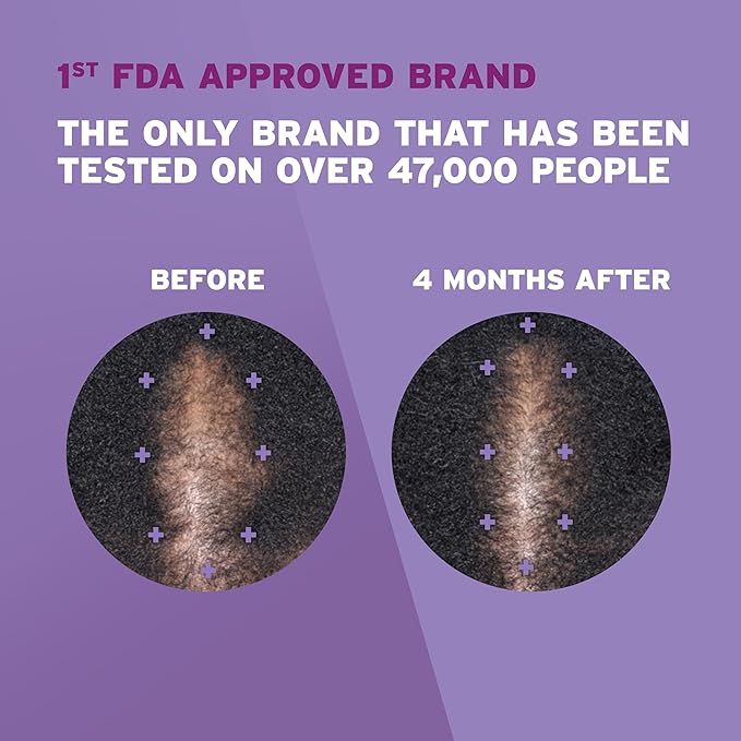 Rogaine for Women 5% Minoxidil Foam, Growth Treatment for Thinning & Hair Loss, Once-A-Day Unscented Topical Foam, Regrow Fuller Thicker Hair, Dermatologist Recommended, 4-Month Supply, 2 x 2.11 oz