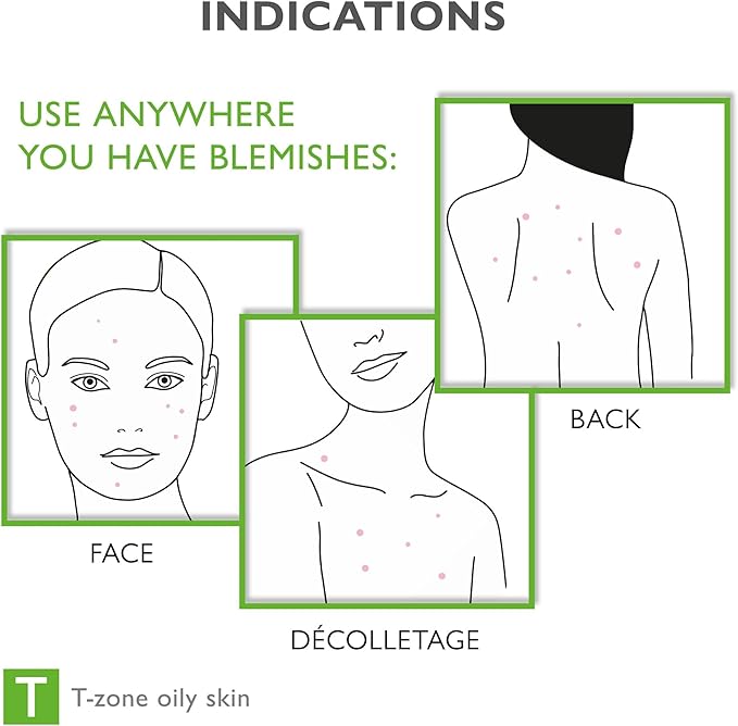 Face & Body Breakout Solution, 3% Mandelic Acid, Helps Clarify Blemish & Acne Prone Skin on Face, Back and Chest, Helps Clear Breakouts, Purifying Cleanser, SEBO-ALMOND-CLARIS, 6.42 fl oz