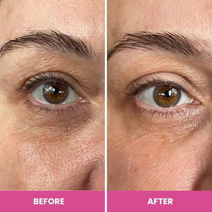 PRIME PROMETICS PrimeEyes Hydrate Under Eye Cream for Mature Women – Hydrating Eye Cream for Dark Circles and Wrinkle Repair – Soft, Glowing & Healthy Under Eyes