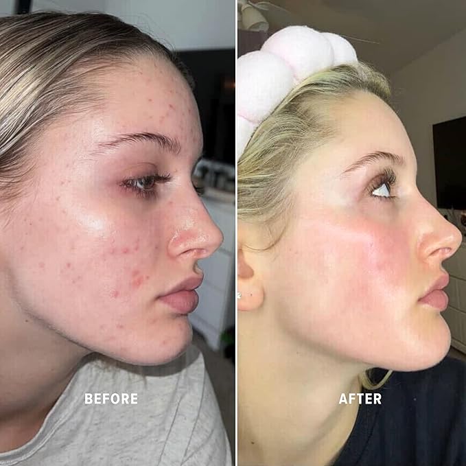 Infinite Aura Face Moisturizer, Hydrating Ceramide & Hyaluronic Acid Cream with Copper Peptide (GHK-Cu) & Vitamin C, Barrier-Repair for Dry/Sensitive Skin, 1.7 oz