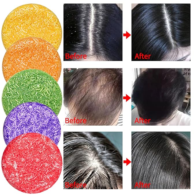 8 Pack Shampoo Bar Gift Set,Natural Soap, Solid Dry Damaged Hair With Plant Essence Oil Helps Stop Loss and Promotes Healthy Growth, Travel Size Bulk Set