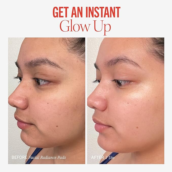 First Aid Beauty - Facial Radiance Pads with Glycolic & Lactic Acids, Daily Exfoliating Pads with AHA, Visibly Smaller Pores, Help Tone & Brighten Skin, One-Step Makeup Prep, Compostable, 28, 3ct