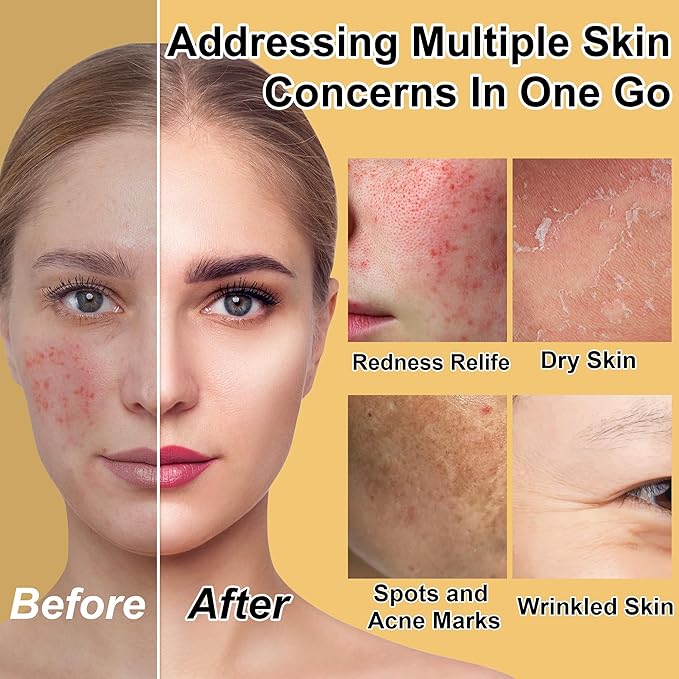 Skin Care Set for Teens Women,Anti-Aging Deeply Hydrates Repairs Skincare Gift Set for All Skin,Facial Skin Care Products Routine Kit Christmas Beauty Gift Set for Women