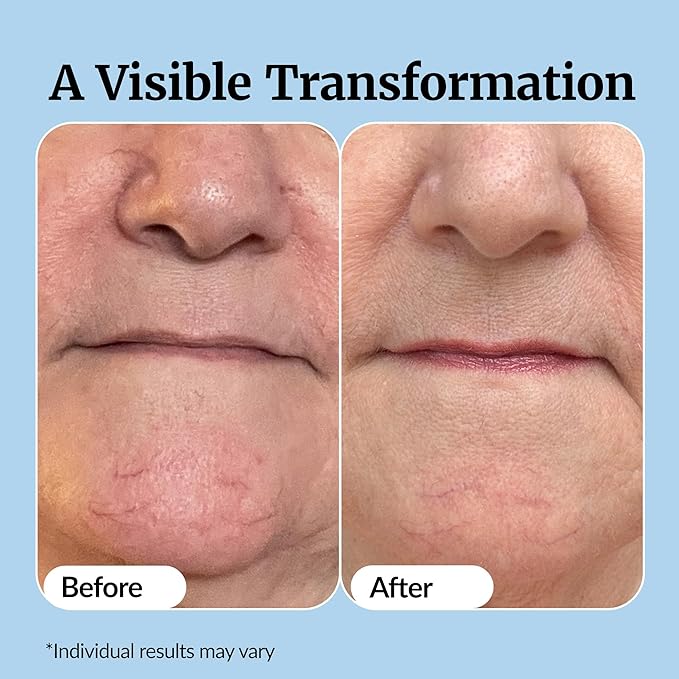 Vibriance Super C Serum for Mature Skin - All-in-One Vitamin Formula Hydrates, Firms, Lifts, Smooths, Targets Age Spots, Wrinkles, 1 fl oz - Pack of 2