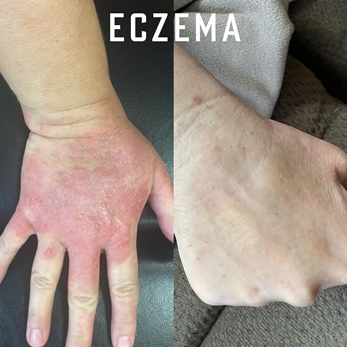 Pure Organic Ozonated Olive Oil Extra Strength 1200 Peroxide For Face and Skin Helps In Acne, Anti-Aging, Wrinkles and Rosacea For Sensitive Skin Made in Spain