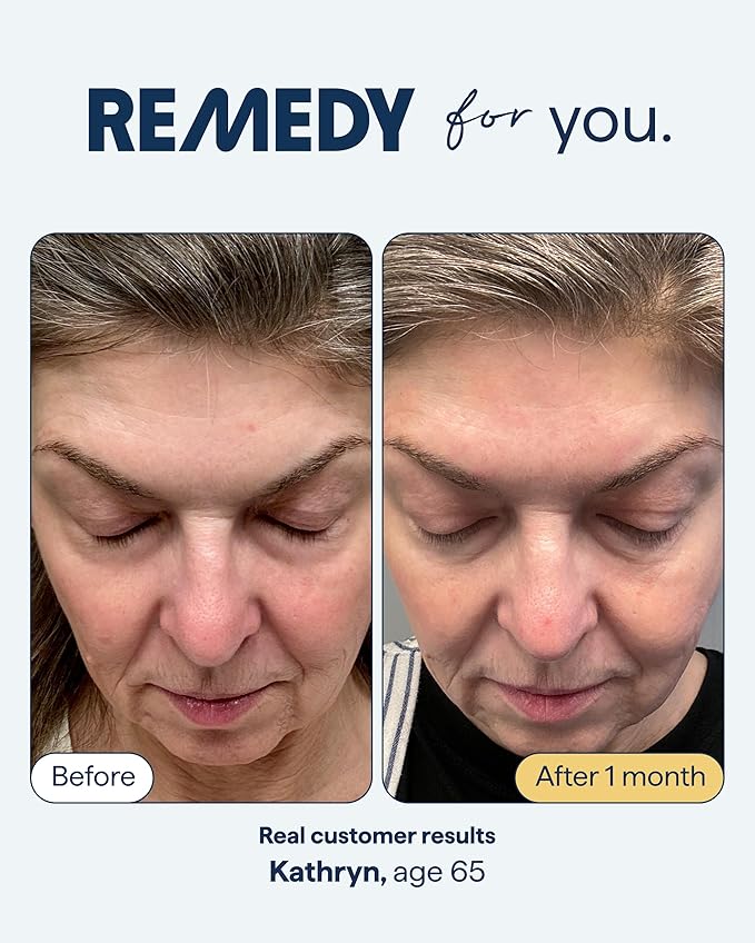 Remedy for Healthy Aging - Retinaldehyde, Resveratrol, Glycolic Acid, Argireline, Ferulic Acid, Matrixyl 3000 - Anti-Aging Treatment for Wrinkles, Uneven Texture & Tone - By Dermatologist Dr. Shah