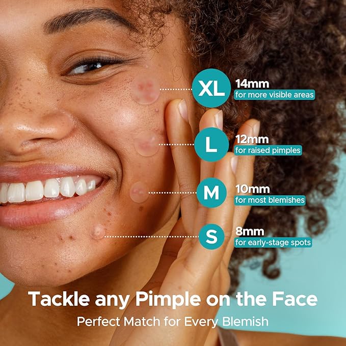 TKTK Hydrocolloid Acne Patches, Pimple Patches for Face with Tea Tree & Calendula Oil - 4 Sizes Clear Cover Stickers, Invisible for Day & Night Use (180 Count)