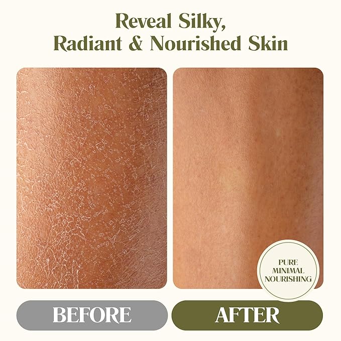 Grass-Fed Whipped Beef Tallow Balm with 100% Cold-Pressed Organic Hemp Seed Oil, Organic Calendula & Organic Rose, Pure Moisturizer for Sensitive Skin, Face, Hair & Body, 4-oz | Non-Toxic