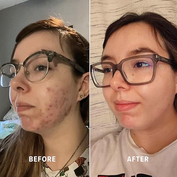 Infinite Aura Face Moisturizer, Hydrating Ceramide & Hyaluronic Acid Cream with Copper Peptide (GHK-Cu) & Vitamin C, Barrier-Repair for Dry/Sensitive Skin, 1.7 oz