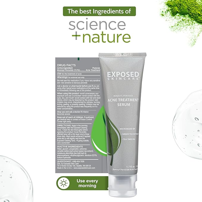 Exposed Skin Care Acne Treatment Serum – Lightweight Acne Spot Treatment with Micro Benzoyl Peroxide, Green Tea & Tea Tree Oil, Quickly Clears Pimples and Breakouts, 2.7 Fl Oz