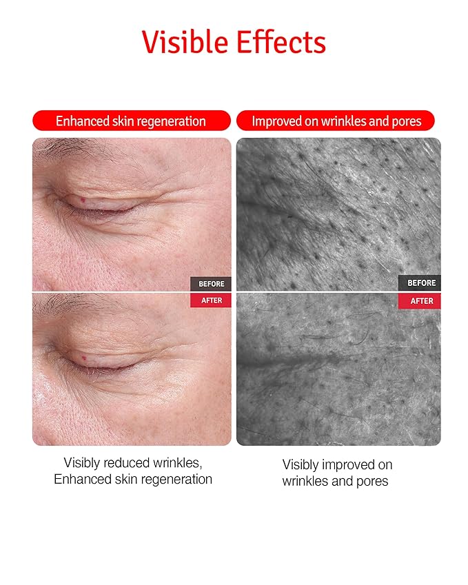 Wrinkle Cream - Age Defying Skin Recovery Moisturizer with Peptides, Vitamin C, Shea Butter - Wrinkle Repair Moisturizing Day & Night Skincare for Face and Neck - Fragrance Free, 1.69oz.