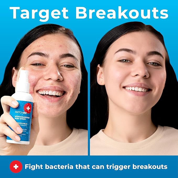 Hypochlorous Acid Spray (8oz, 2 packs), HOCL Facial Cleanser Acne Spray for Face, Body, Eczema, Pimples, Breakouts & Overall Skin Recovery (Reduces Redness)