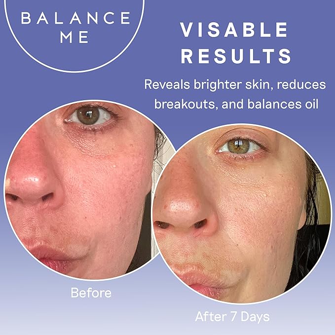 Balance Me Pure Skin Face Wash, Gentle Foaming Facial Cleanser with Moringa & Rice Bran (1 x 4.23 fl oz), Non Toxic Water-Based Facewash for Oily, Blemish-Prone & Sensitive Skin