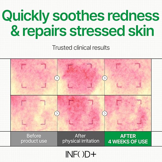 INFODPLUS Repair Cream 50ml – Exosome & Ceramide Complex | Barrier Repair, Hydrating, Anti-Aging Face Moisturizer for Sensitive Skin