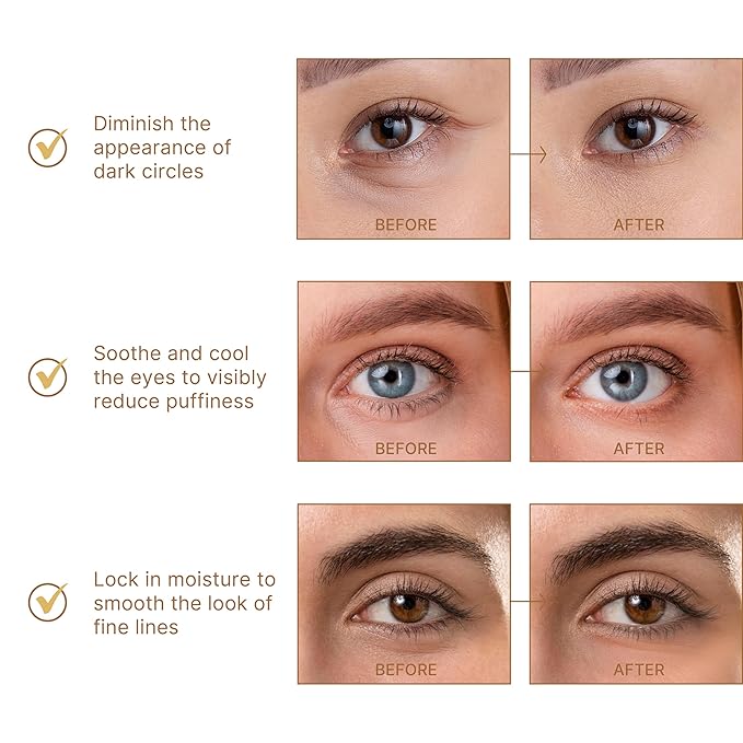 BRAWNA Hydrogel Undereye Mask Patch with Retinol, Collagen, Peptides, Hyaluronic Acid - For Puffy Eyes, Dark Circles, Undereye Bags - Vegan Cruelty-Free Skincare Birthday Gifts for Women - 24 Pairs